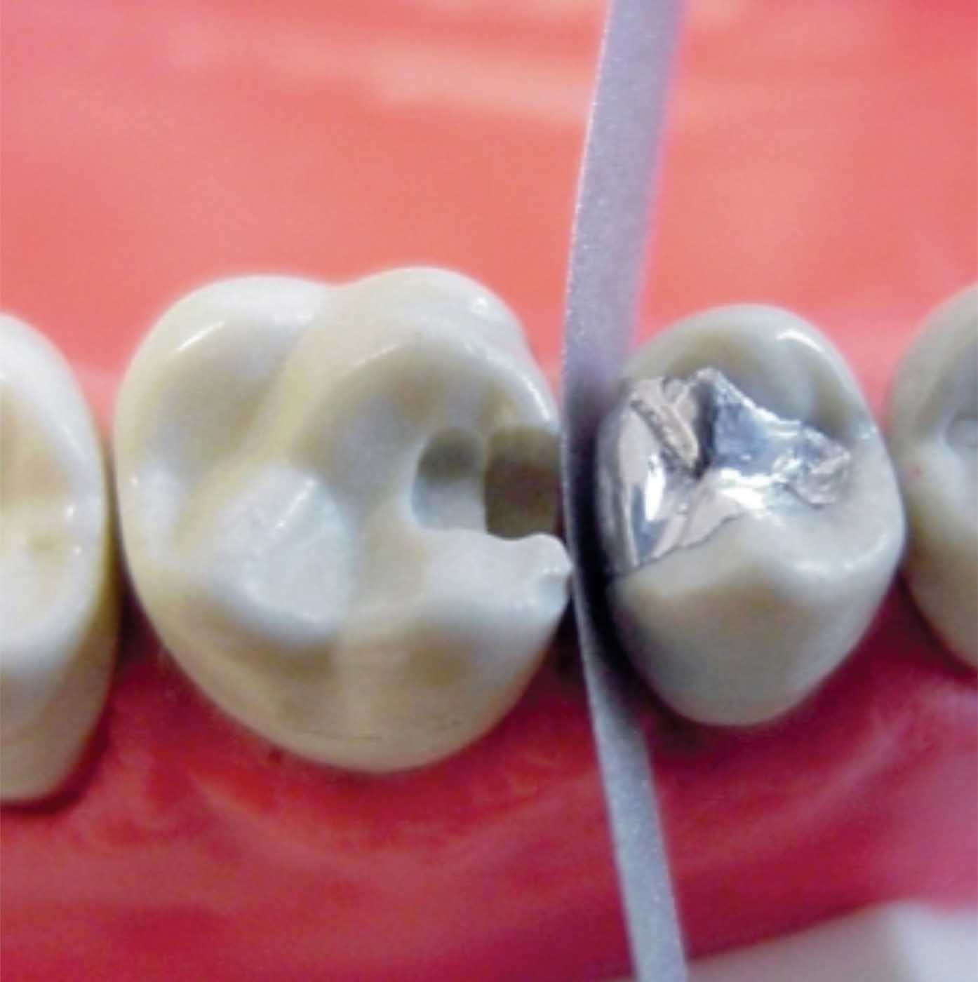 Tiras Abrasivas en Acero por 12 Unidades - Imagen 2