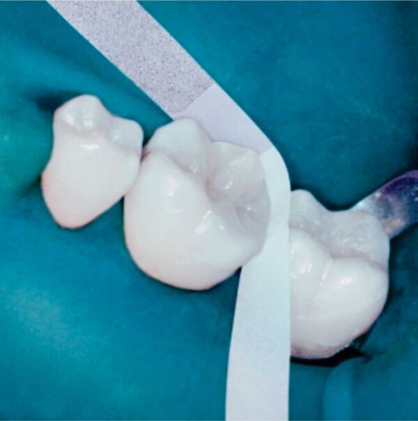 Lija de Acabado Proximal por 150 Unidades. - Imagen 2