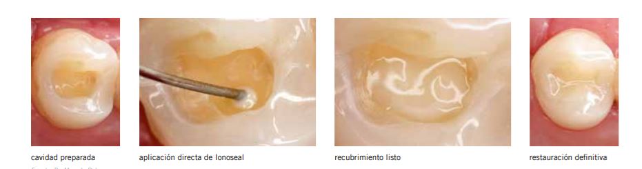 Ionoseal - Imagen 2