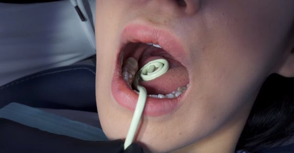 Eyectores Flexbend - Imagen 2